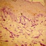 Fibres �lastiques cutan�es