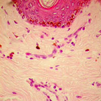 effet anti-inflammatoire 