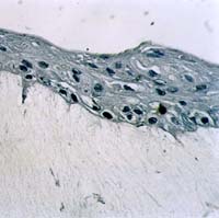 �quivalent dermique 