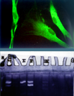 Cellular Cultures : fibroblasts and keratinocytes