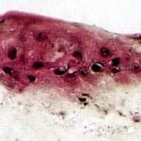 Analyse immunohistochimique