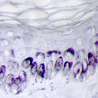 depigmenting or pro pigmenting effect