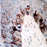 melanic pigmentation of the hair bulb