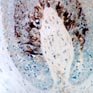 Scalp model